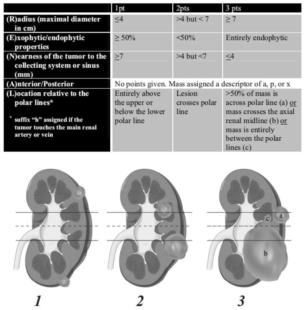 Method for automatically evaluating difficulty of kidney tumor enucleation based on CT (Computed Tomography) image