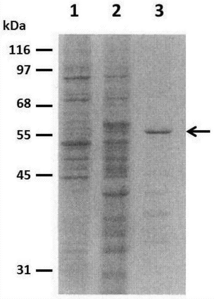 Anti-human papilloma virus L1 protein antibody, and coding gene and application thereof