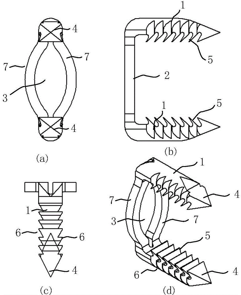 Cervical anterior fixation system and manufacturing method thereof