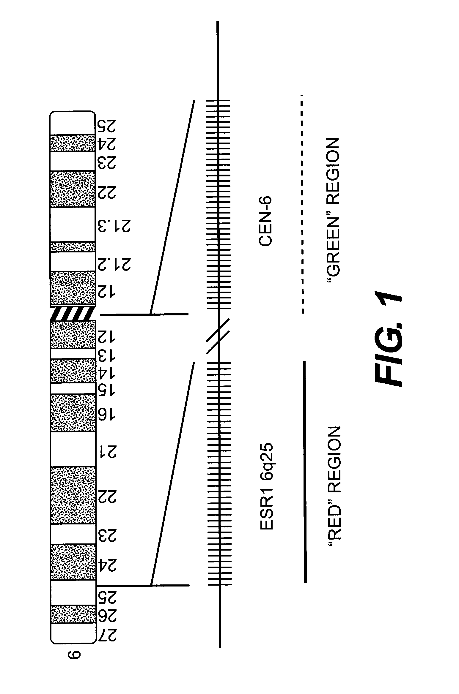 Methods for utilizing esr copy number changes in breast cancer treatments and prognoses
