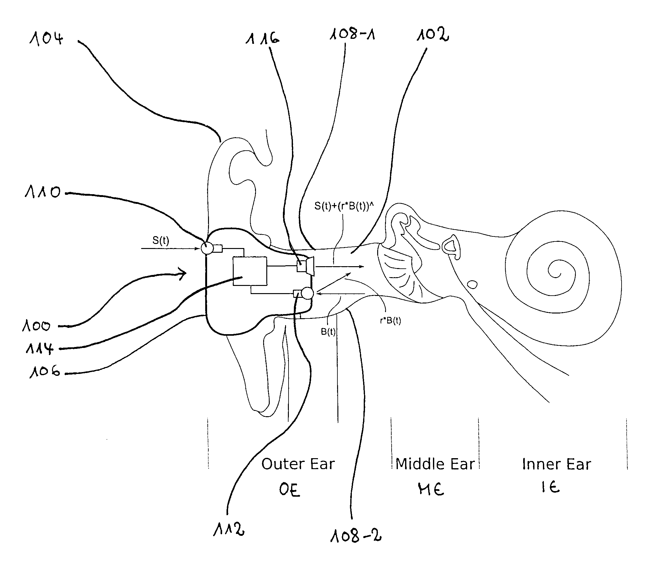 Device and method for in-ear sound generation