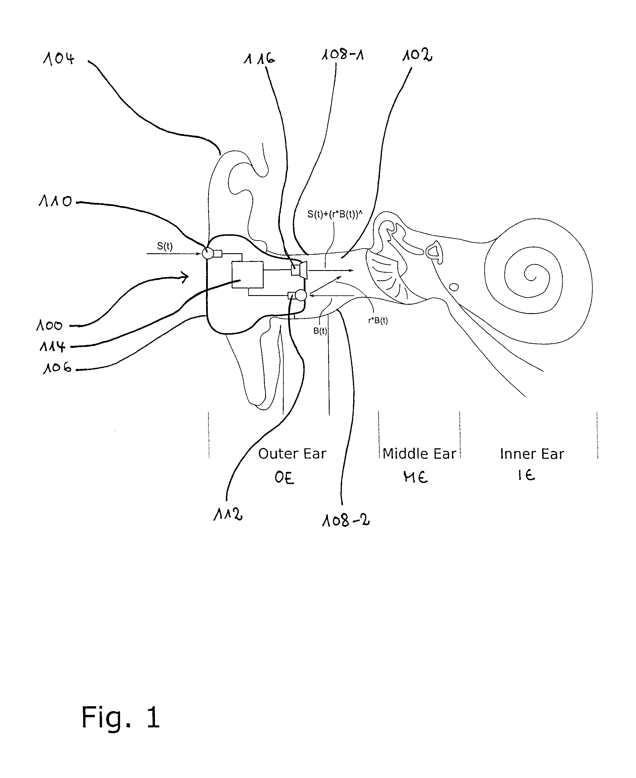 Device and method for in-ear sound generation