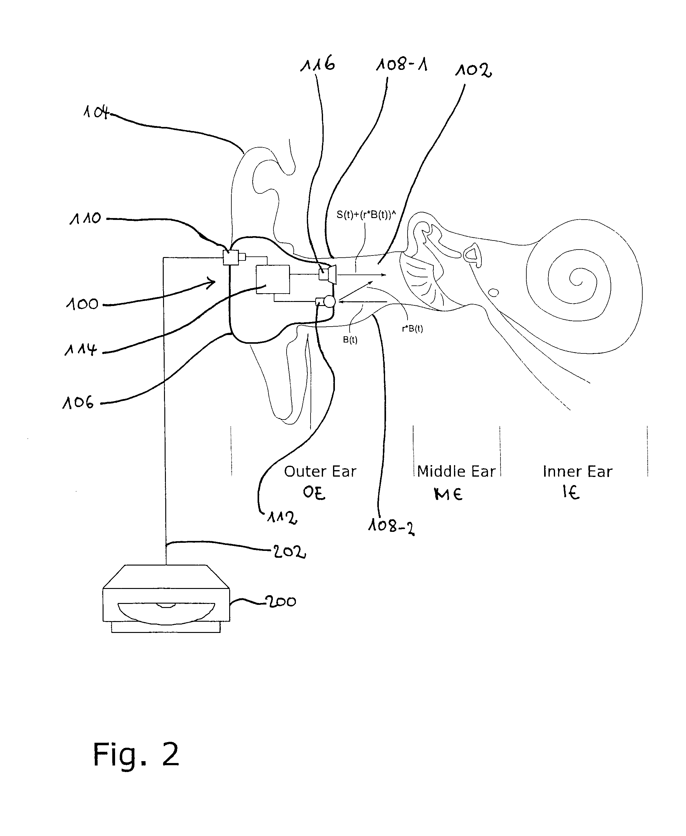 Device and method for in-ear sound generation