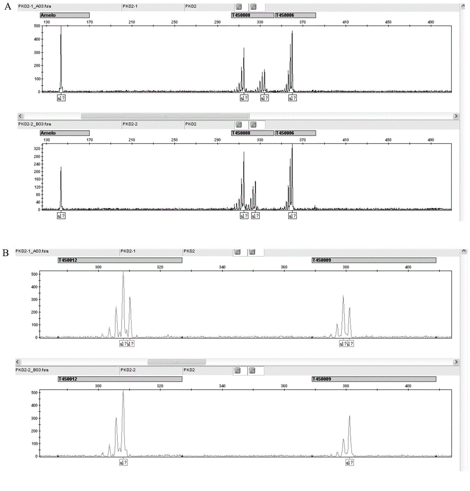 STR sites of PKD2 gene and application of STR sites of PKD2 gene