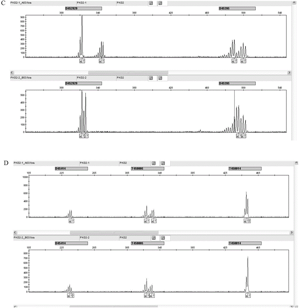 STR sites of PKD2 gene and application of STR sites of PKD2 gene