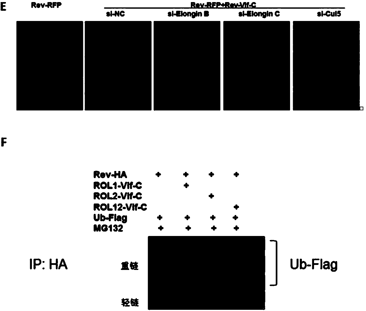 Anti-HIV-1 drugs and preparation and application thereof