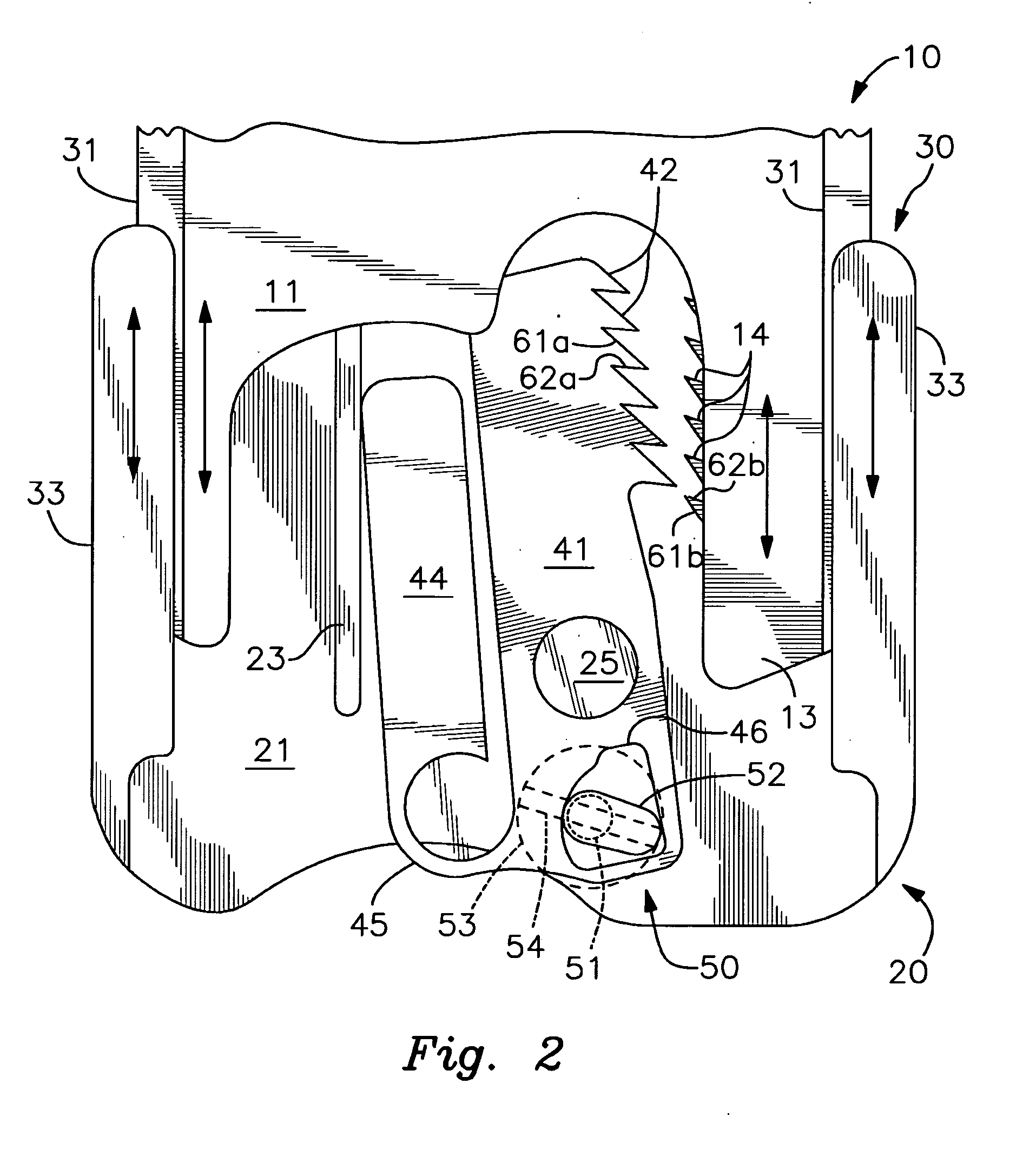 Lock and release mechanism for a sternal clamp