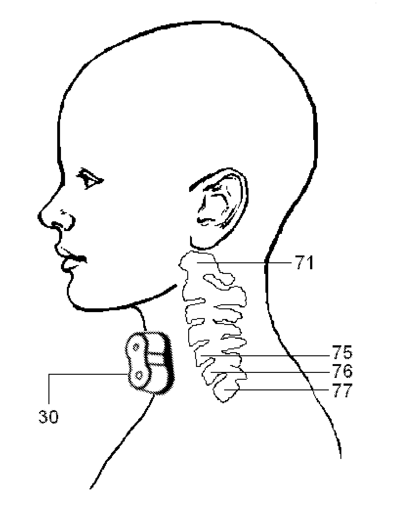 Non-invasive methods and devices for inducing euphoria in a patient and their therapeutic application