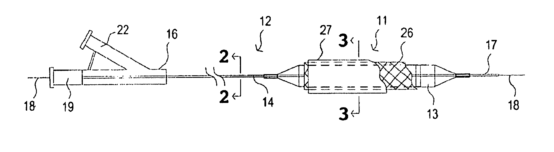 Composite expandable device with impervious polymeric covering and bioactive coating thereon, delivery apparatus and method