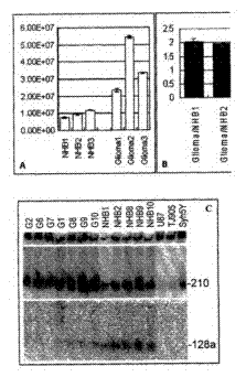 Application of anti-sense miRNA (Ribonucleic Acid)-210 to preparation of anti-cancer drug