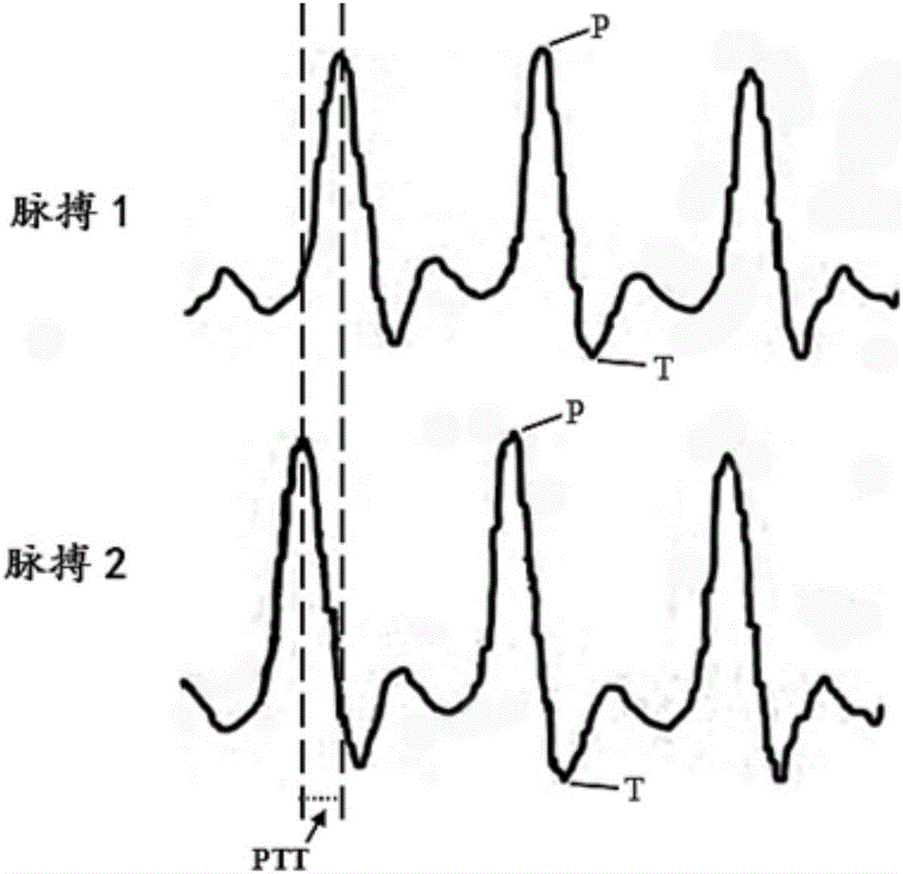 Non-invasive blood pressure detecting system and method based on finger artery waves