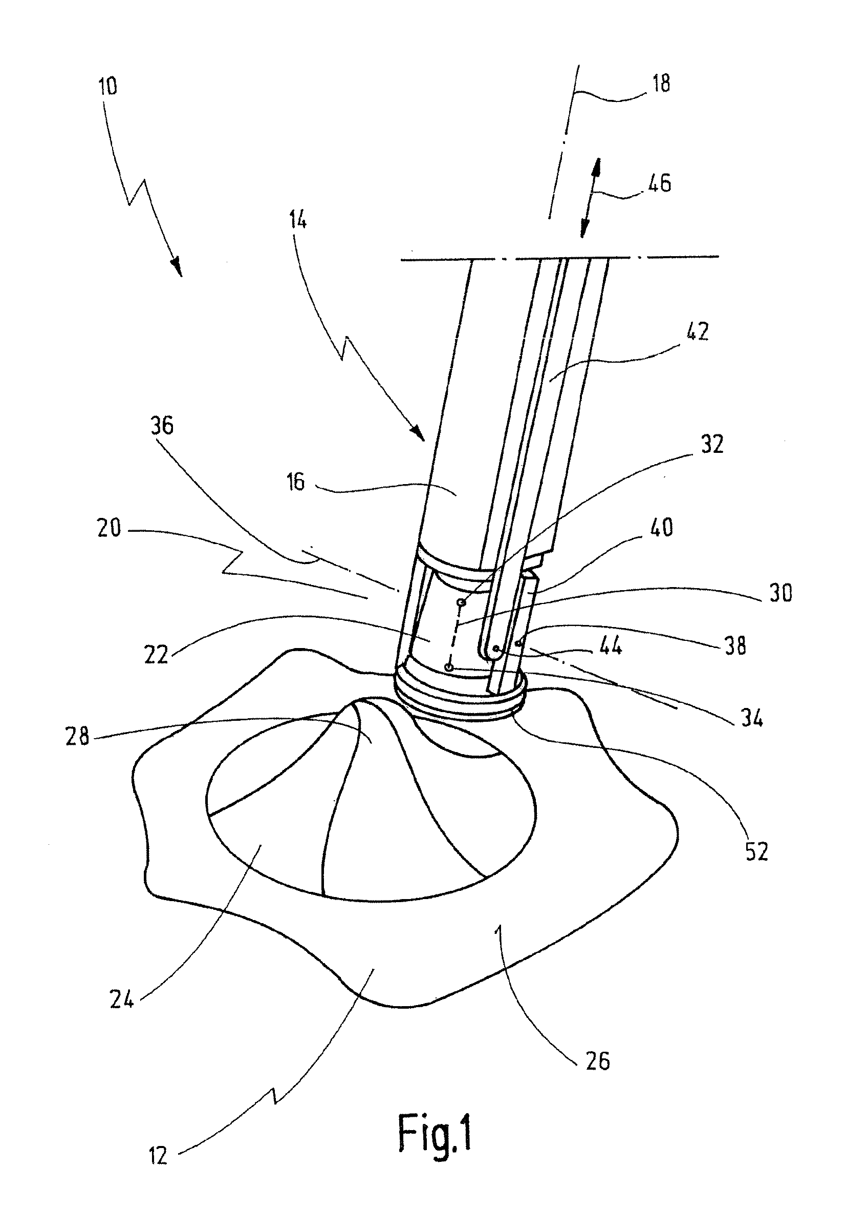 Medical Instrument And Method For Manipulating, In Particular Retracting Tissue Or An Organ