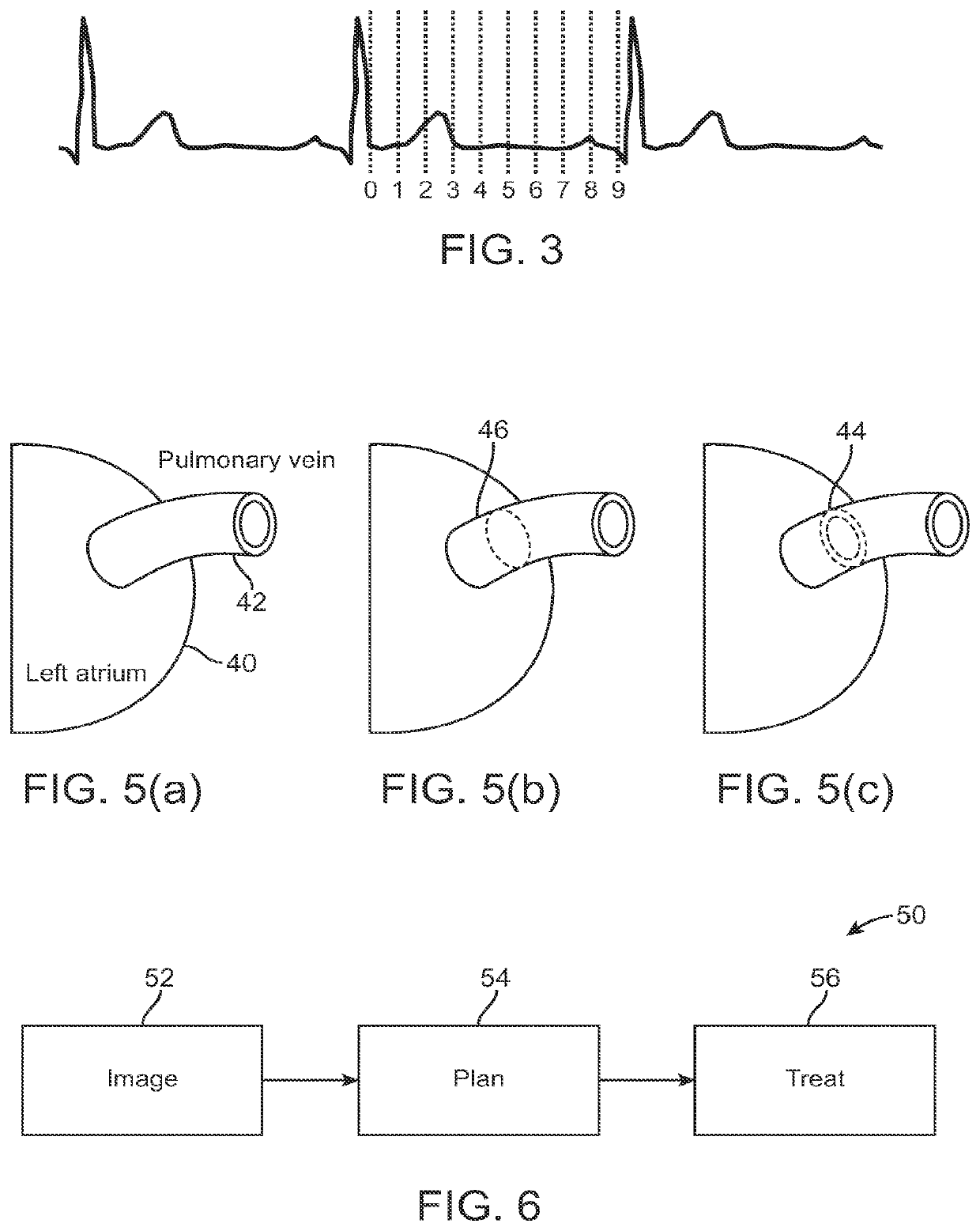 Radiation treatment planning and delivery for moving targets in the heart