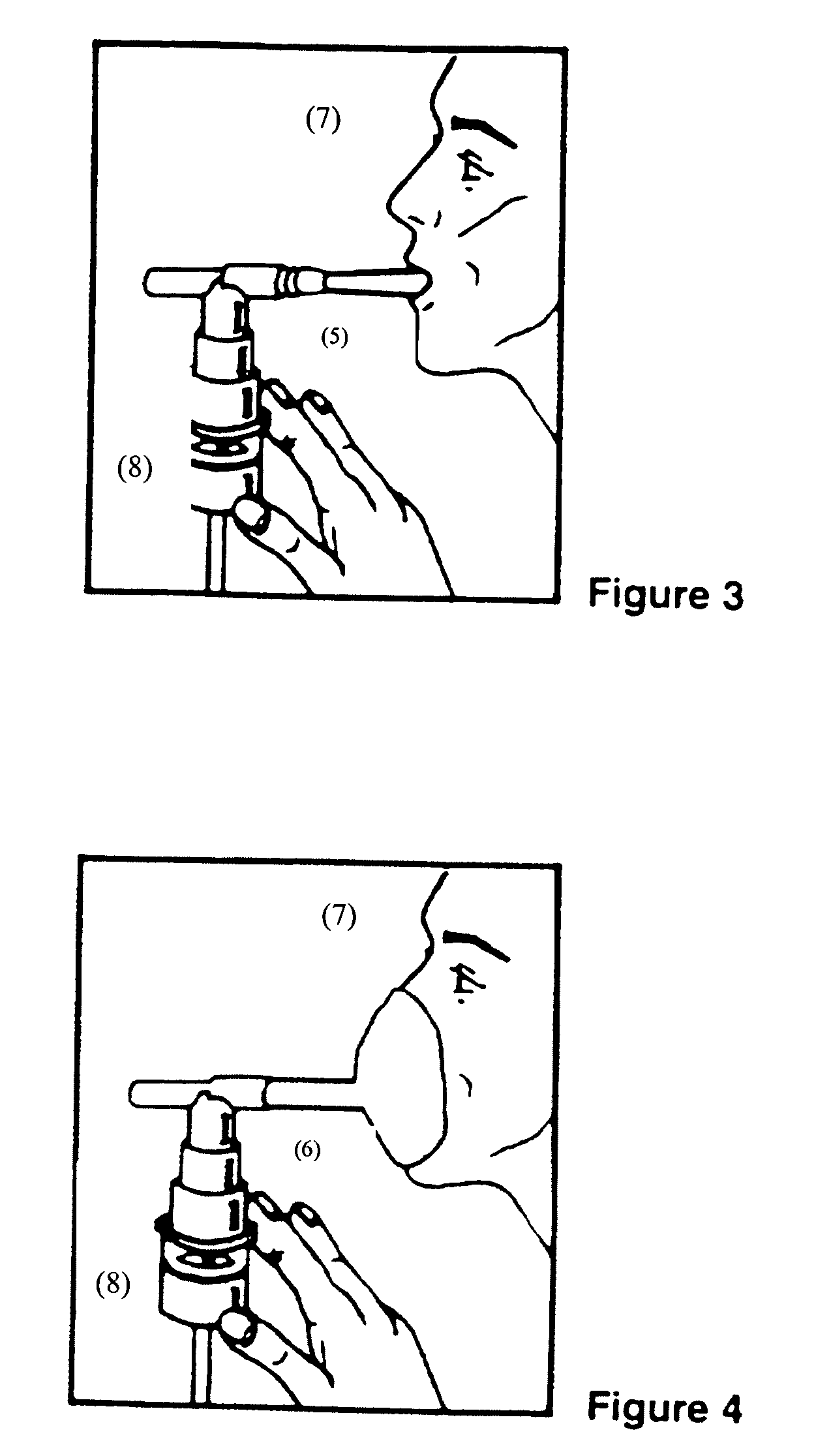 Albuterol inhalation solution, system, kit and method for relieving symptoms of pediatric asthma