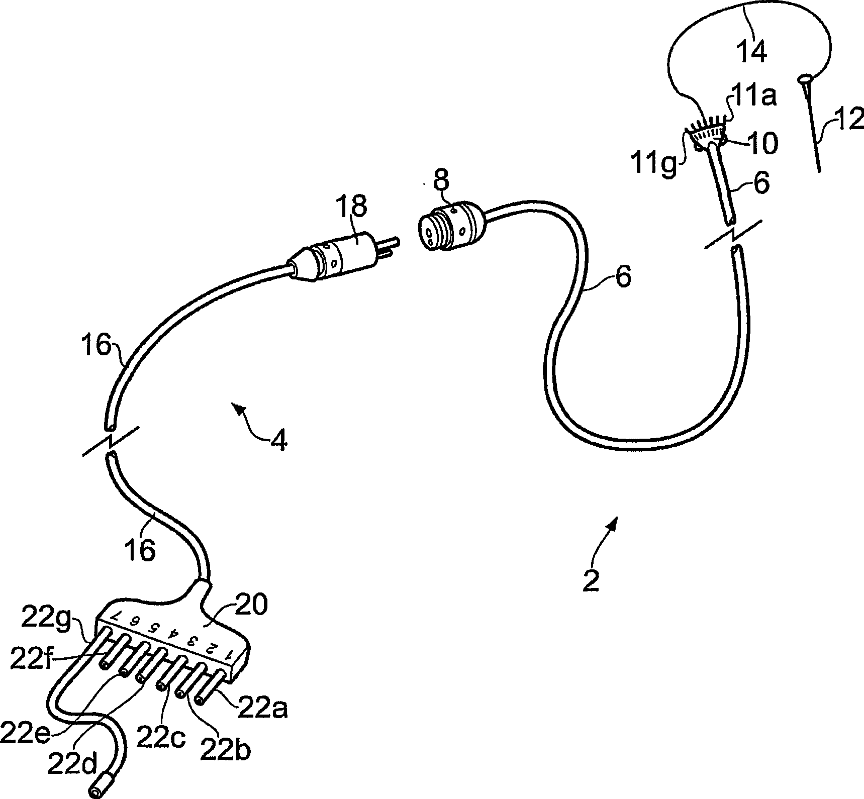 Apparatus for fluid delivery with implantable housing openable for providing access to a fluid connector