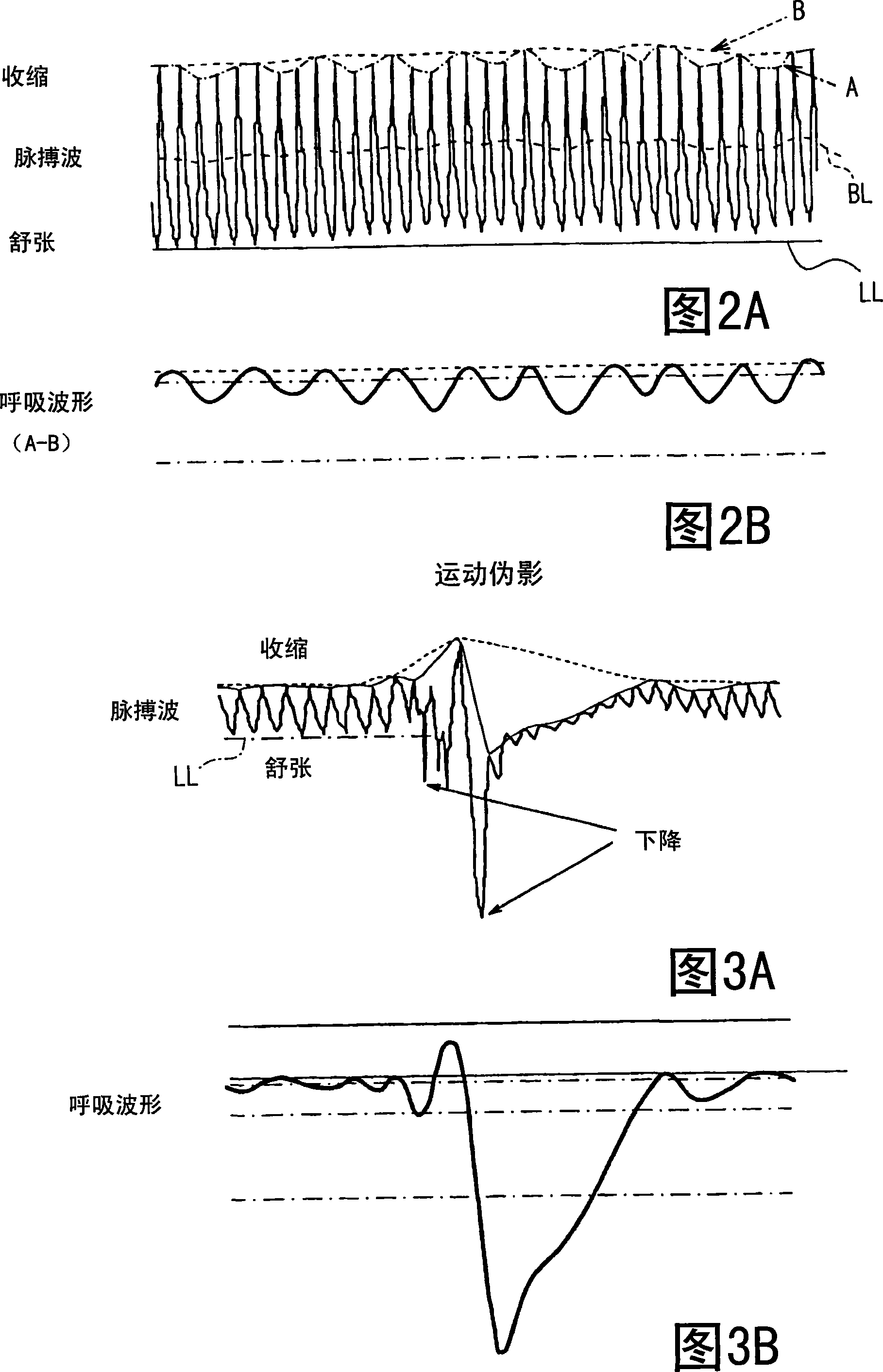 Apparatus for detecting vital functions, control unit and pulse wave sensor