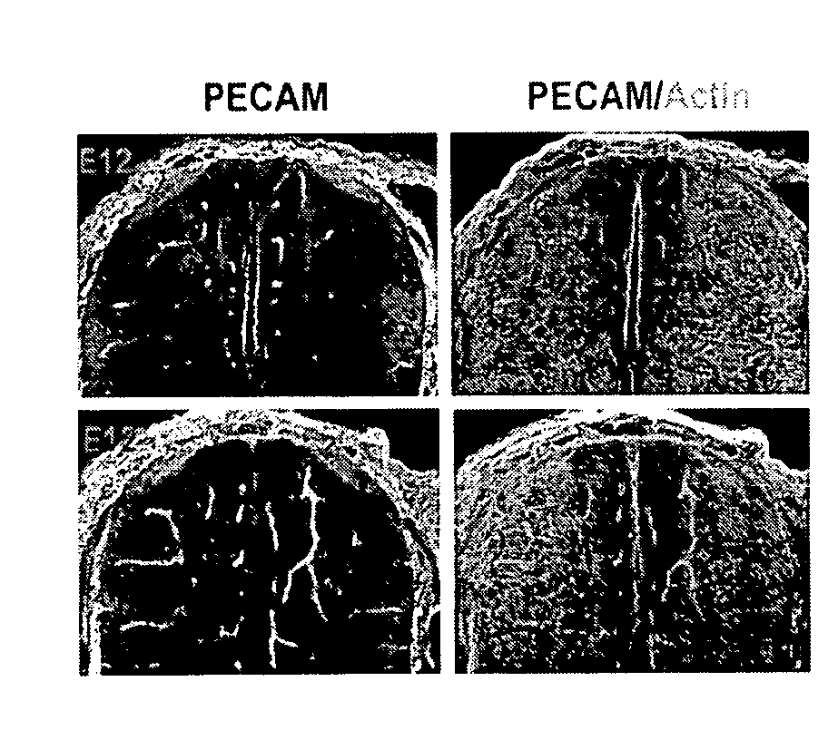 Methods and kits for diagnosis and treatment of cell-cell junction related disorders