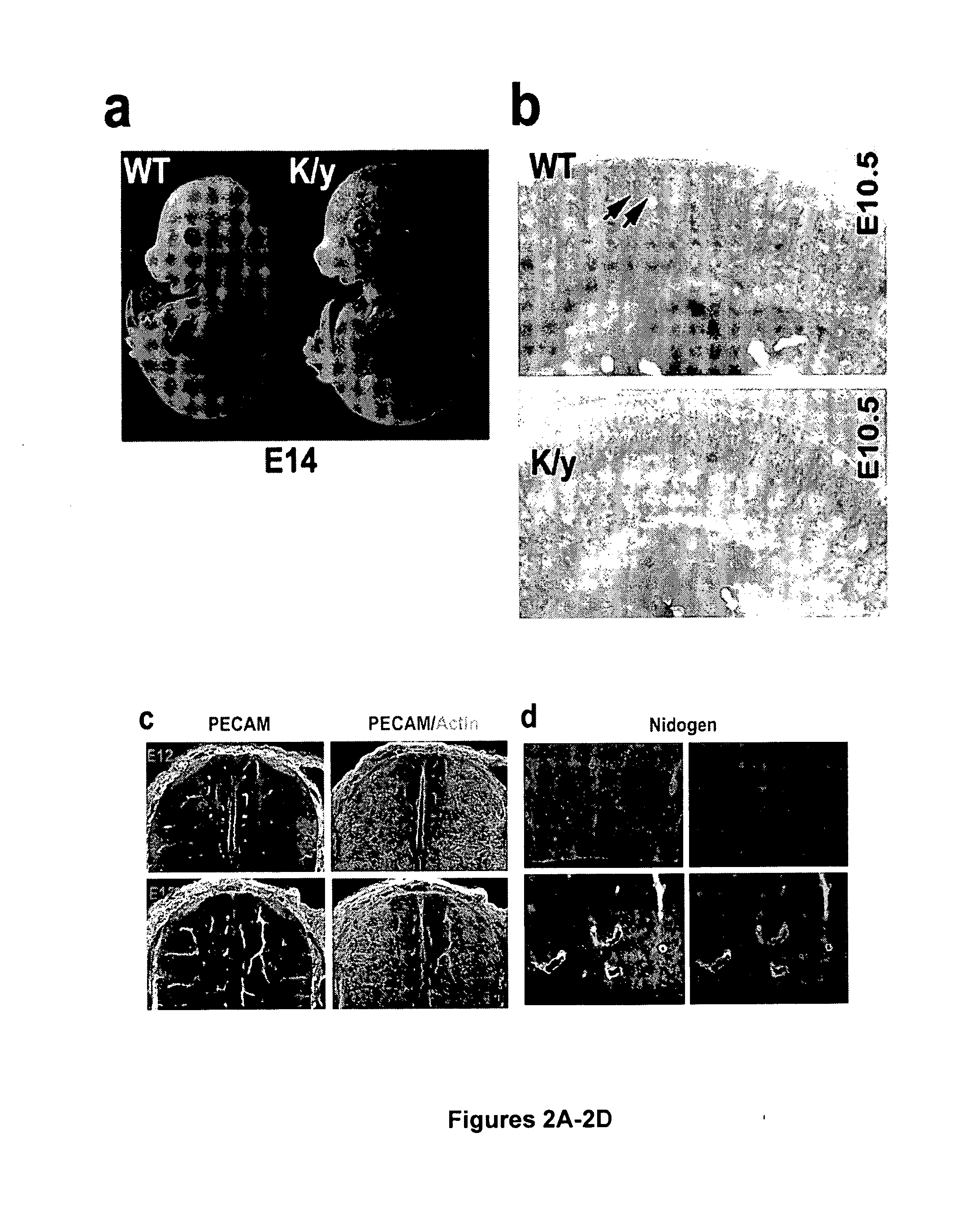 Methods and kits for diagnosis and treatment of cell-cell junction related disorders