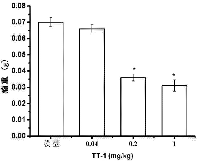 Application of antineoplastic polypeptide TT-1 in preparing antineoplastic medicines