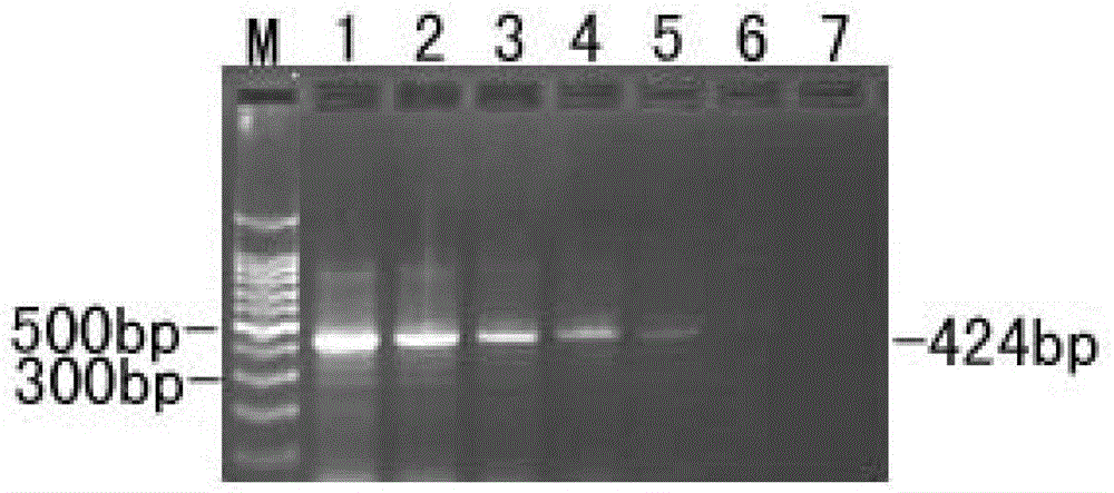 LAMP (Loop-medicated isothermal amplification) detection kit for metapneumovirus