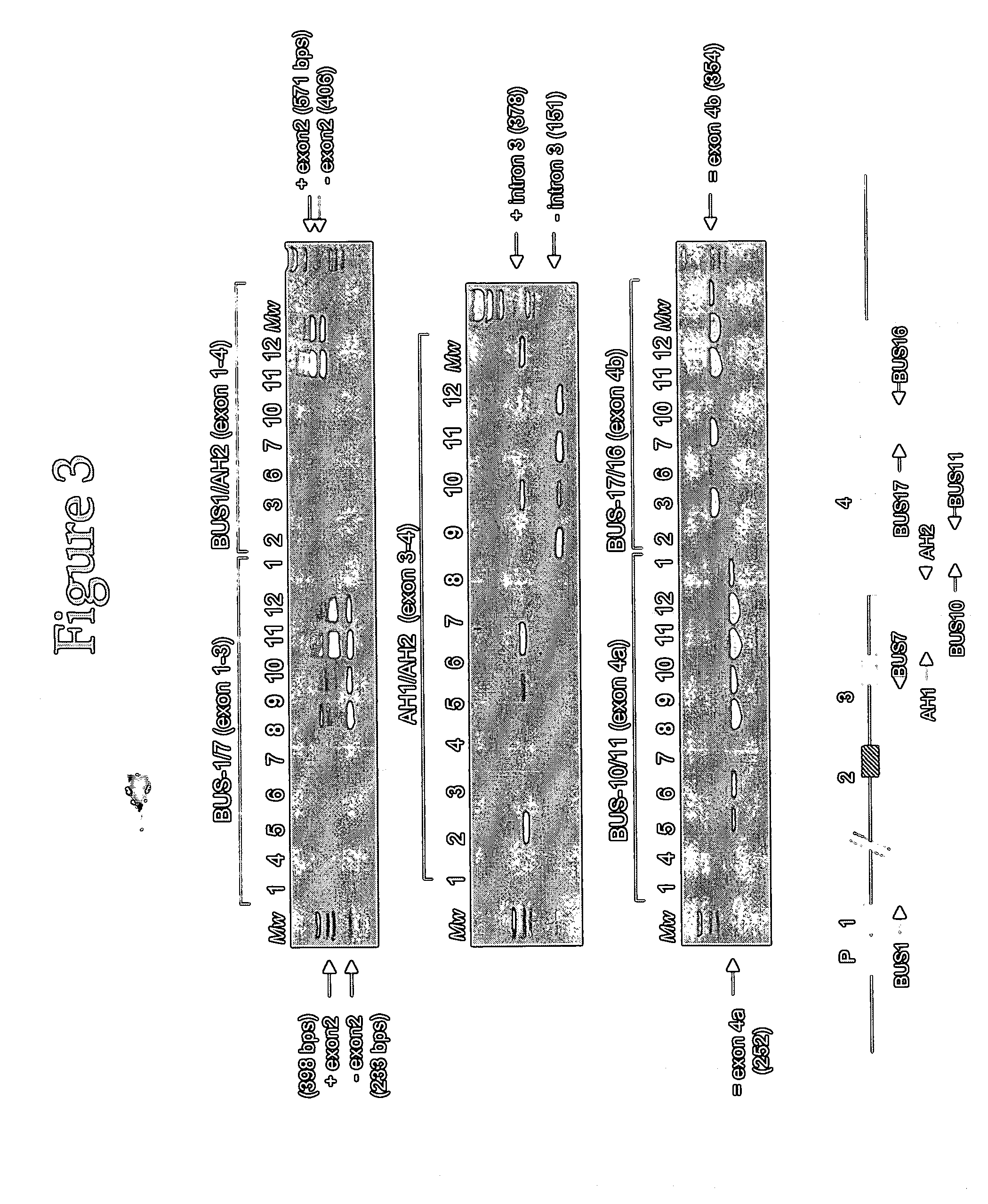 Specific method of prostate cancer detection based on PCA3 gene and kits therefor