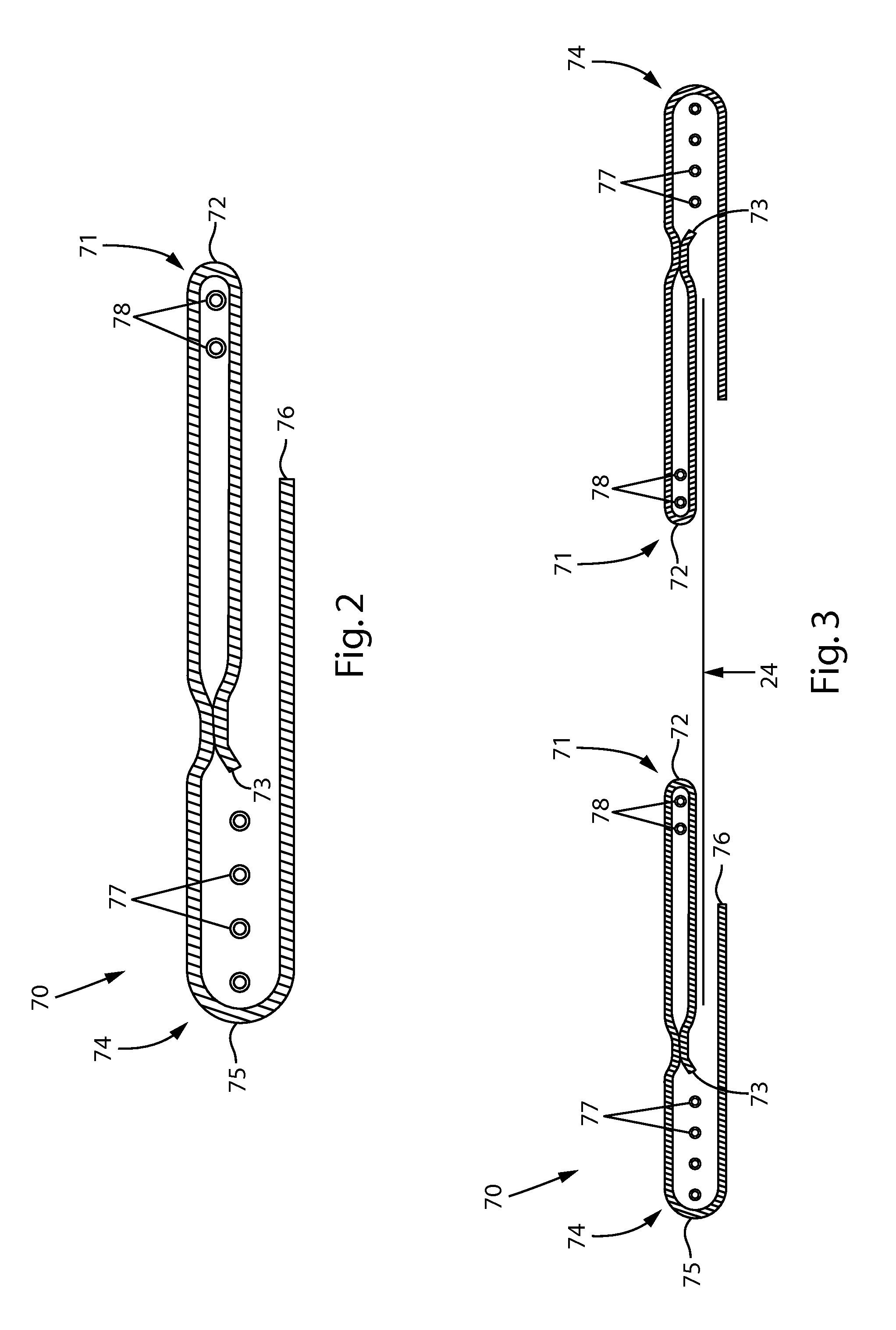 Absorbent Article With Leg Gasketing Cuff