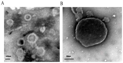 Application of plasma small extracellular vesicle miR-431-5p