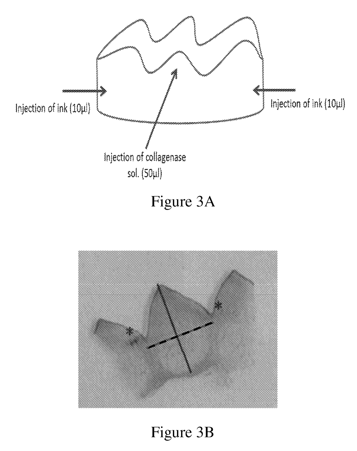 Methods for extracting a tooth