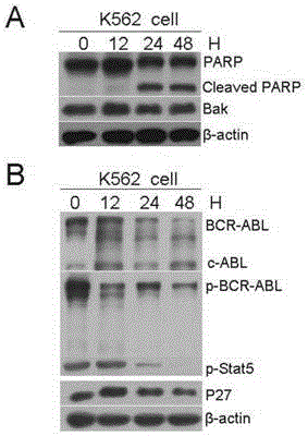 Application of compound Hu-17 single or combined tyrosine kinase inhibitor to preparation of medicine for treating chronic myelogenous leukemia