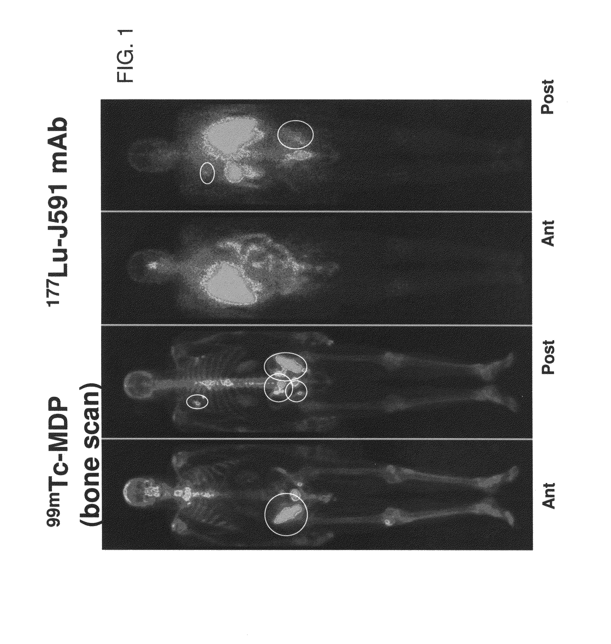 Methods and kits for diagnosis of cancer and prediction of therapeutic value