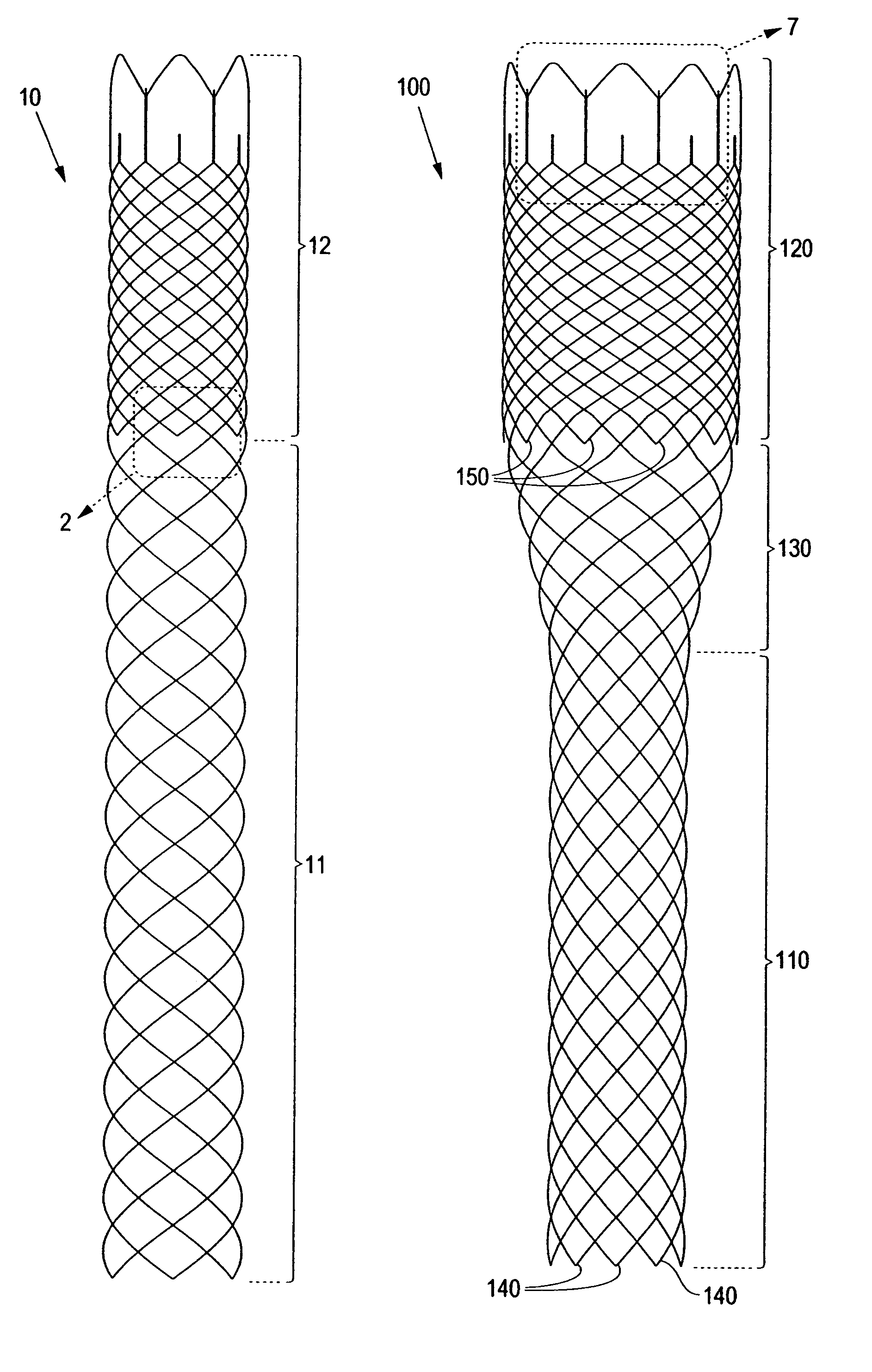 Braided stent and method for its manufacture