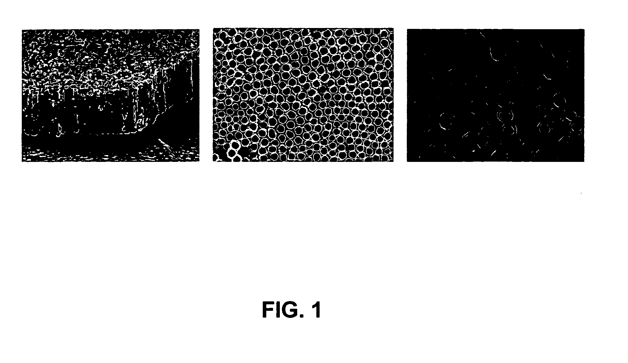 Nanostructure surface coated medical implants and methods of using the same