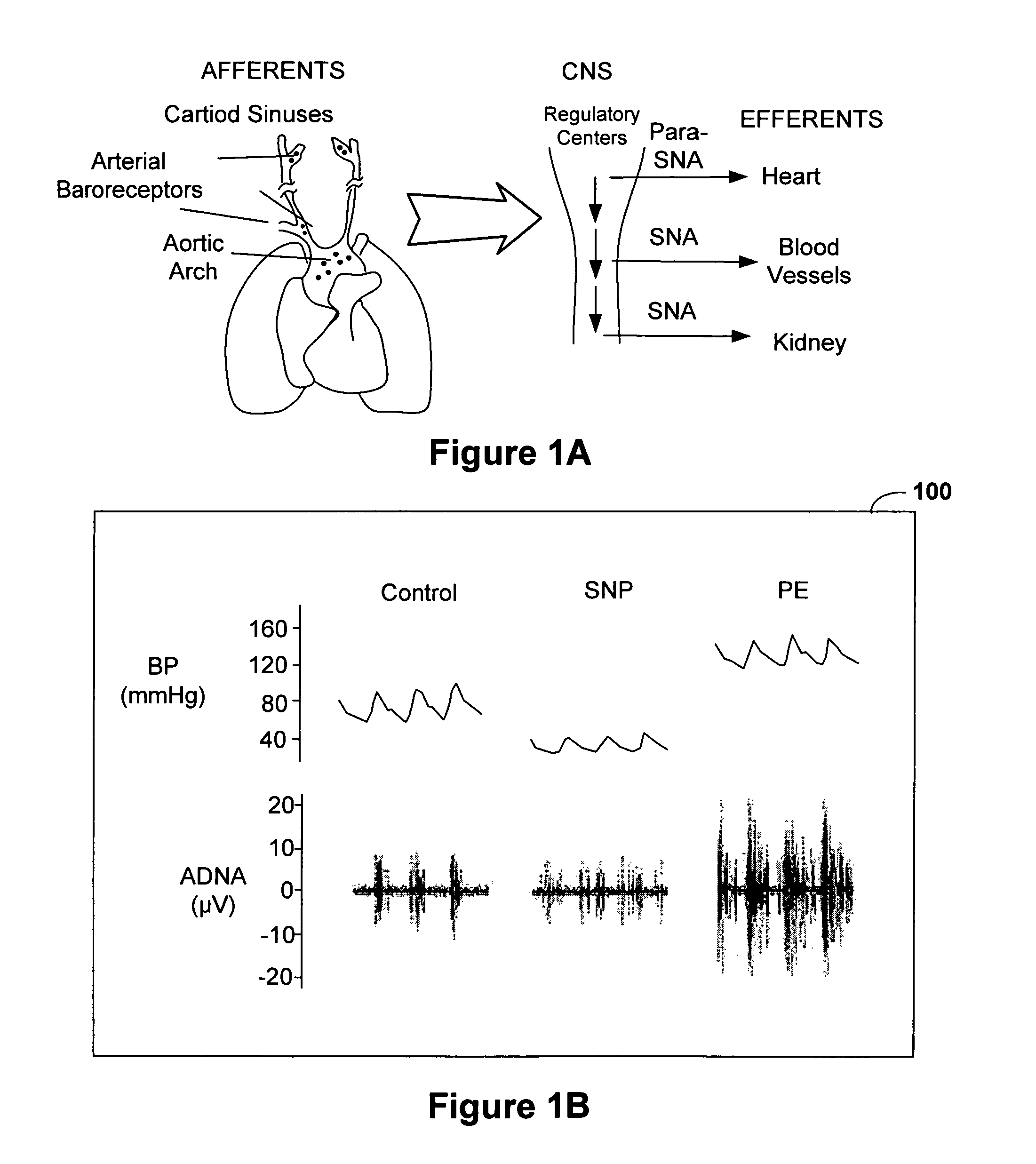 Assessing autonomic activity using baroreflex analysis