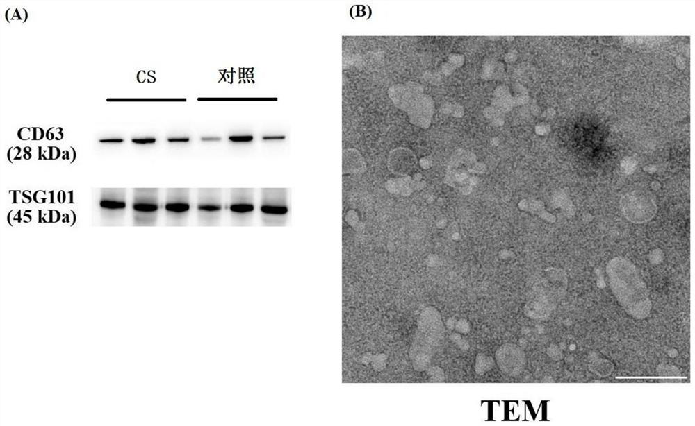 Application of exosomal circular RNA 0109315 as a target in the prevention and treatment of benign prostatic hyperplasia