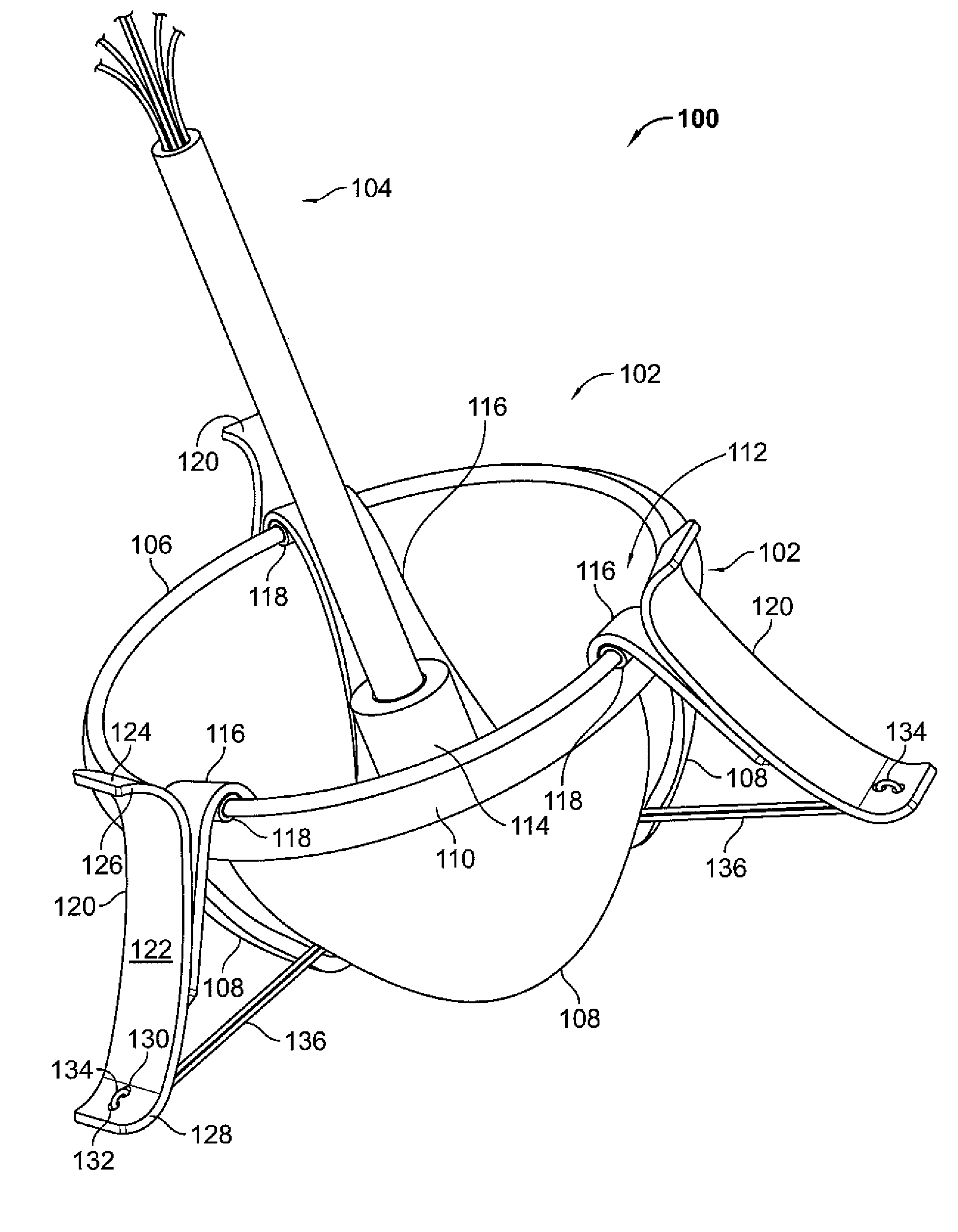 Valve prosthesis systems and methods