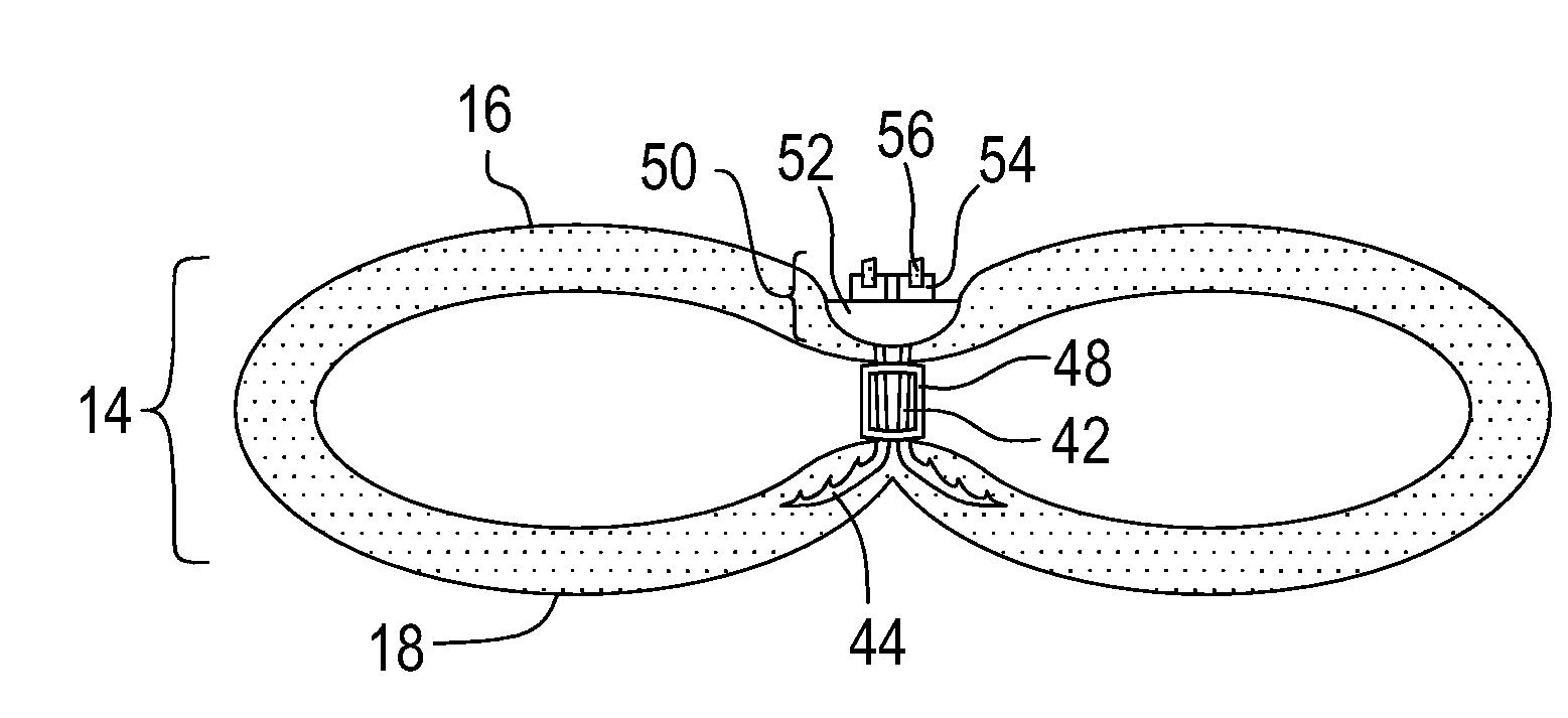 Minimally Invasive Percutaneous Restrictive Bariatric Procedure And Related Device