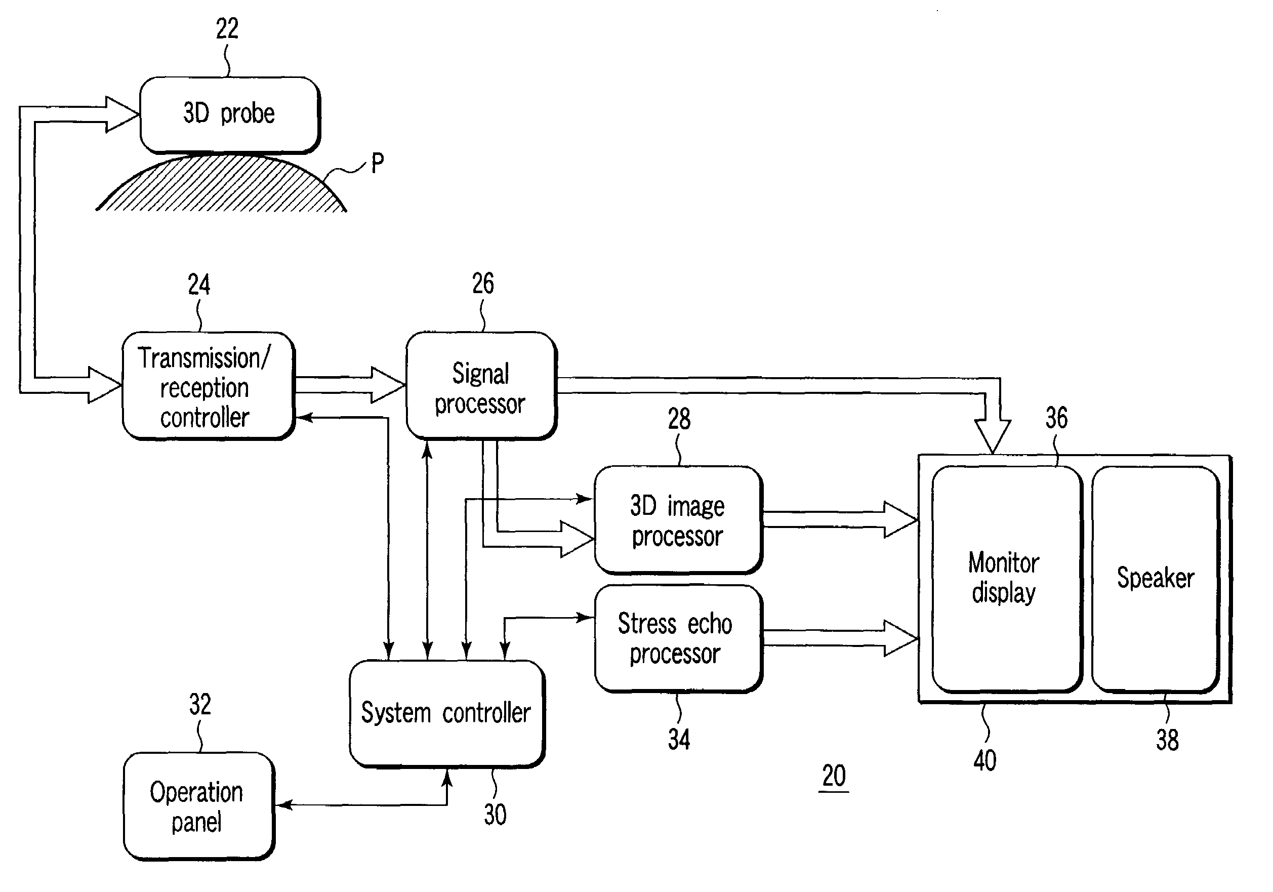 Ultrasonic diagnostic apparatus and diagnostic method of the apparatus