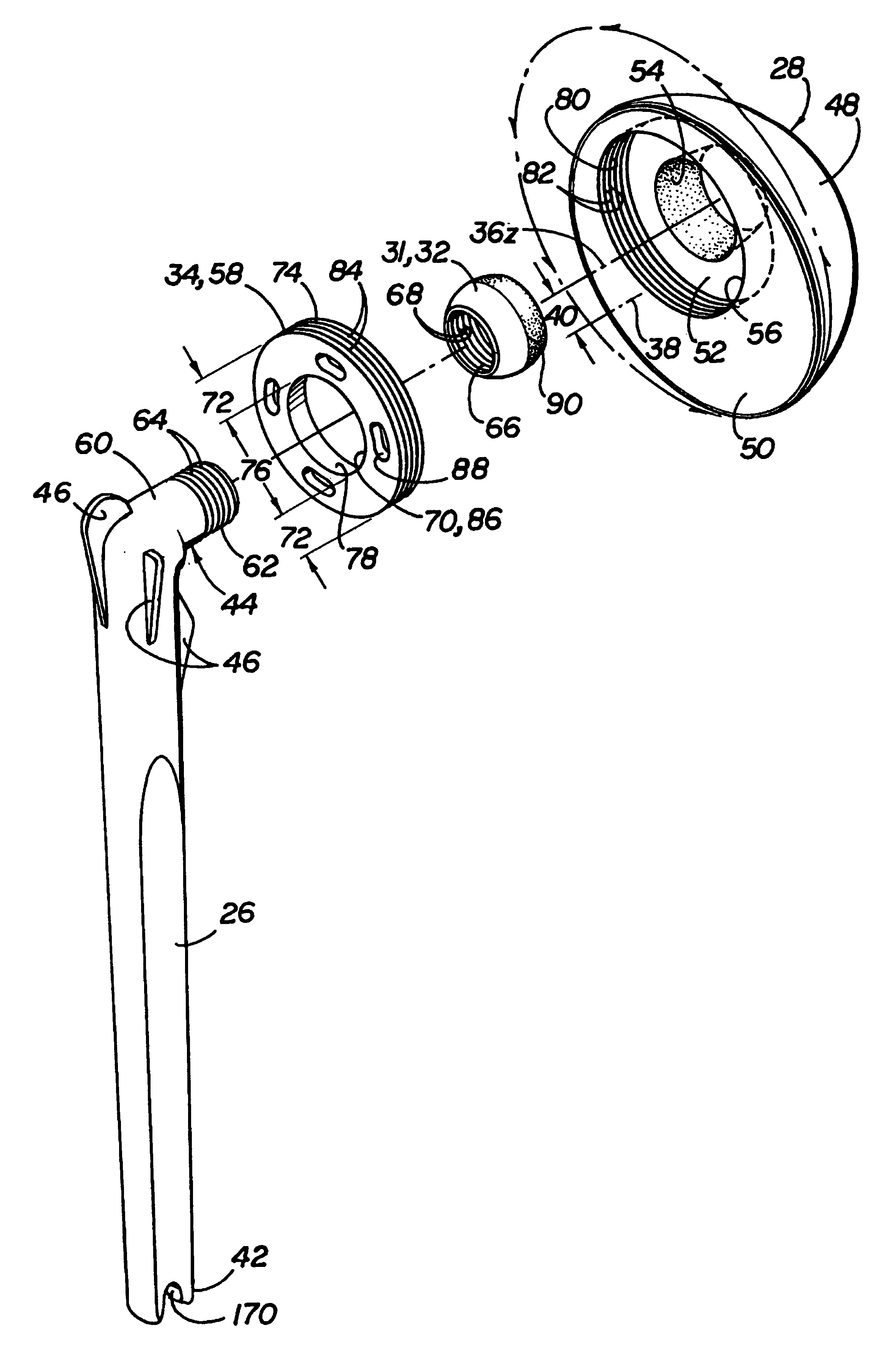 Modular prosthesis system with novel locking mechanism