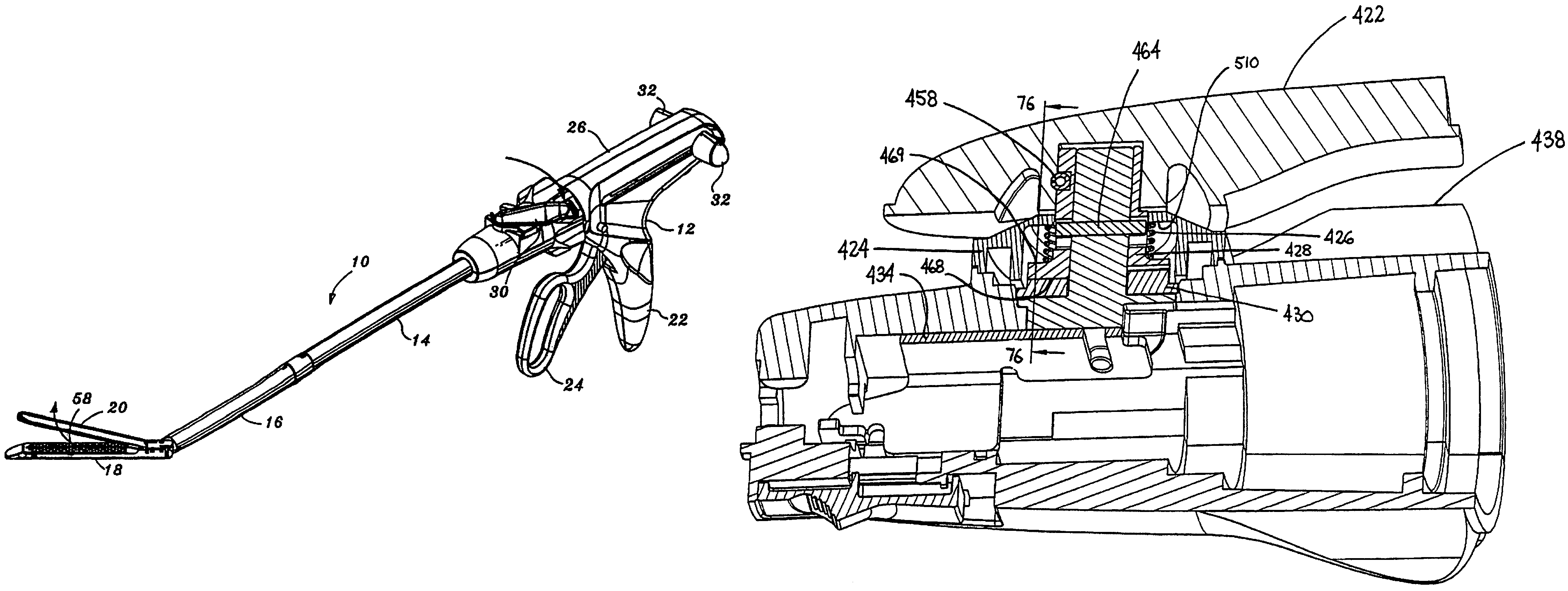 Surgical stapling apparatus