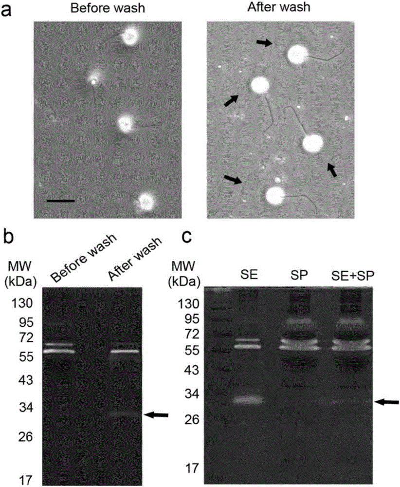 Prostate-specific antigen isomer, coding gene and application thereof