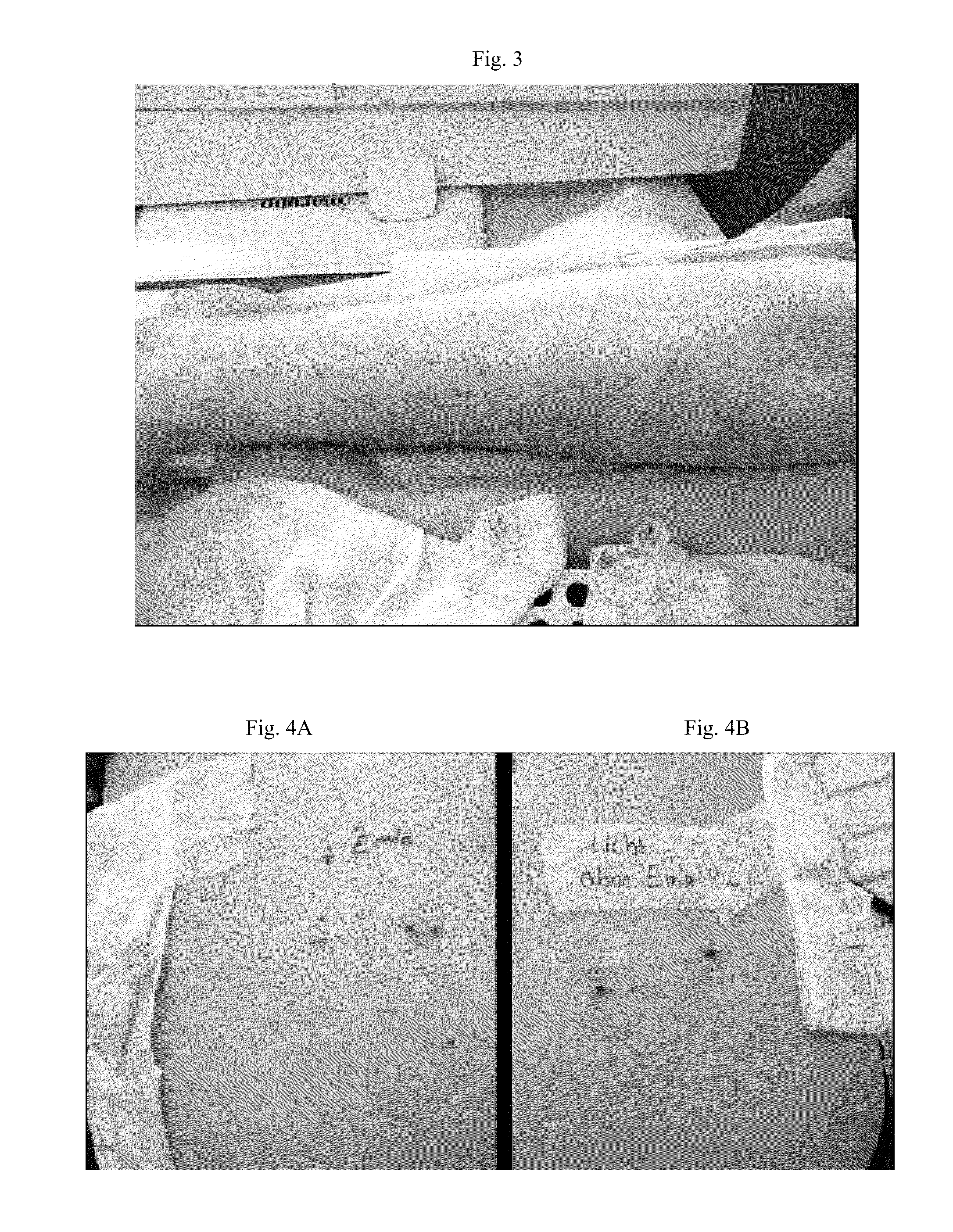 Pharmaceutical Composition for the Treatment of Solar Urticaria