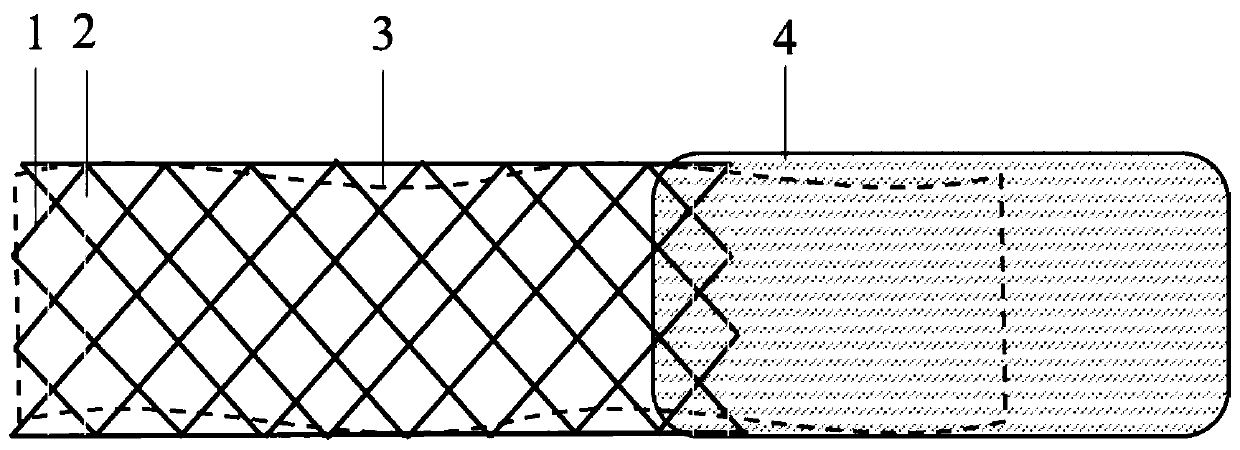 Degradable intestinal stent for rectal anastomosis protection