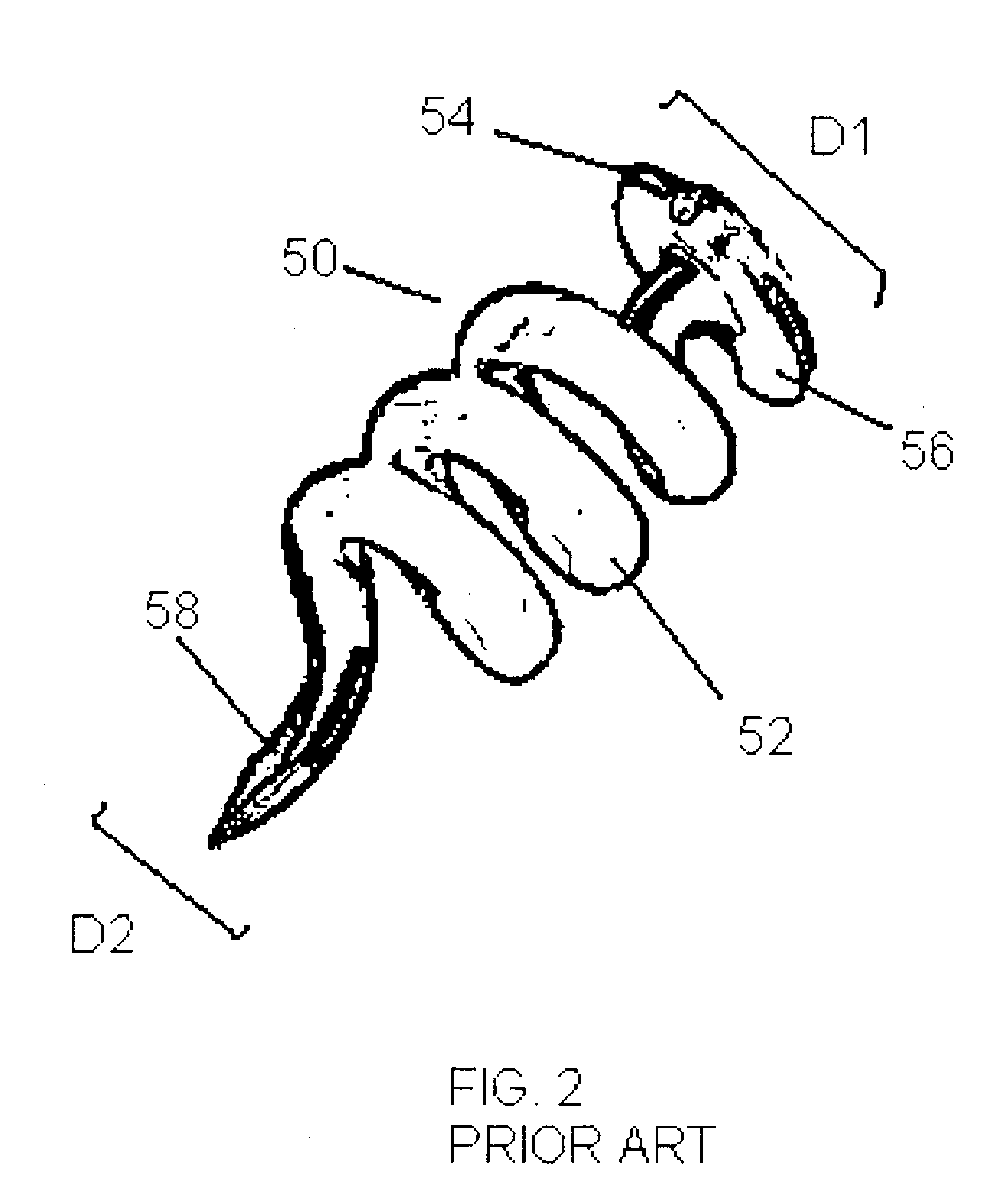 Low profile bioactive agent delivery device