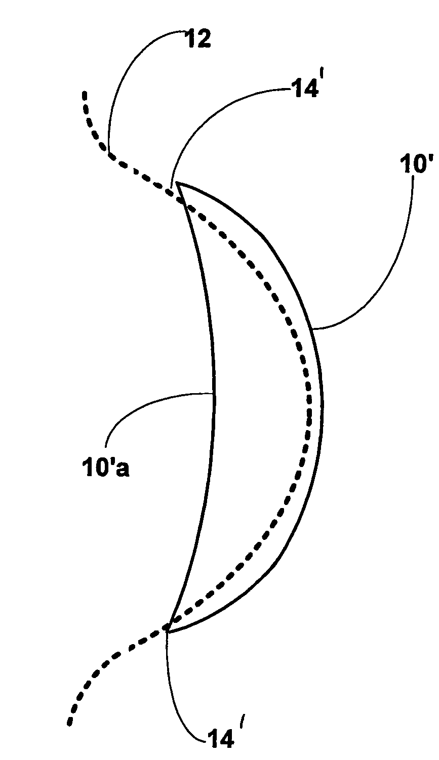 Contact lens with shaped periphery