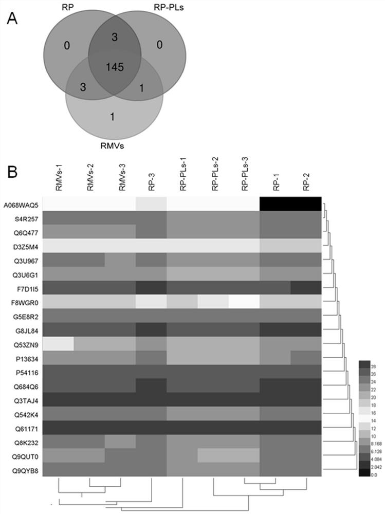 Nano artificial red blood cell and application thereof in preparation of medicine for treating bacterial infection