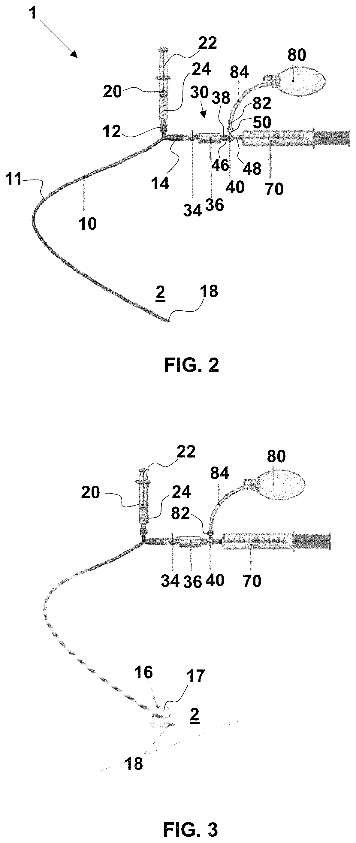 Closed-system bladder drug administration catheter and methods for administering drugs in a closed system