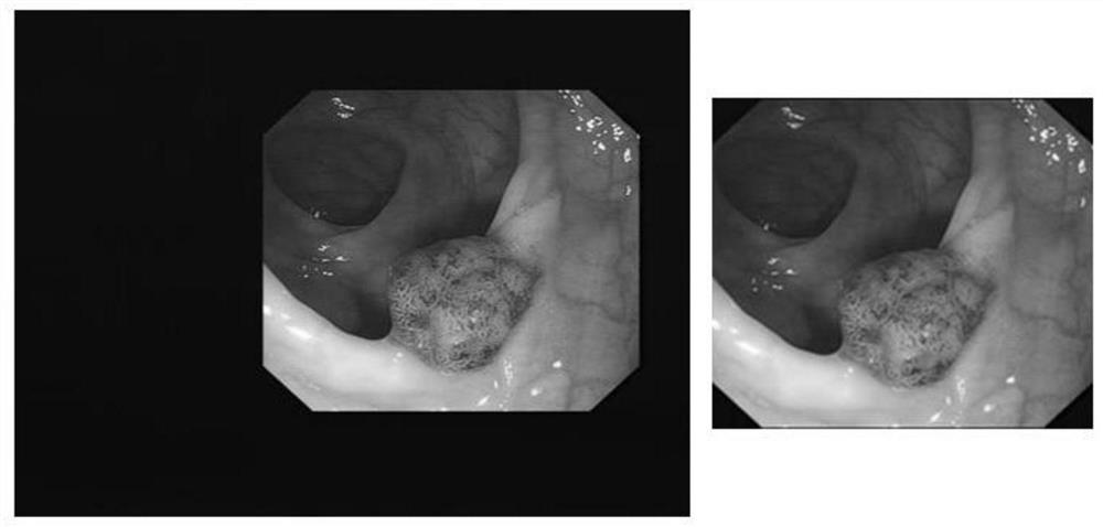 A Method for Detection and Classification of Lesion Areas in Clinical Images