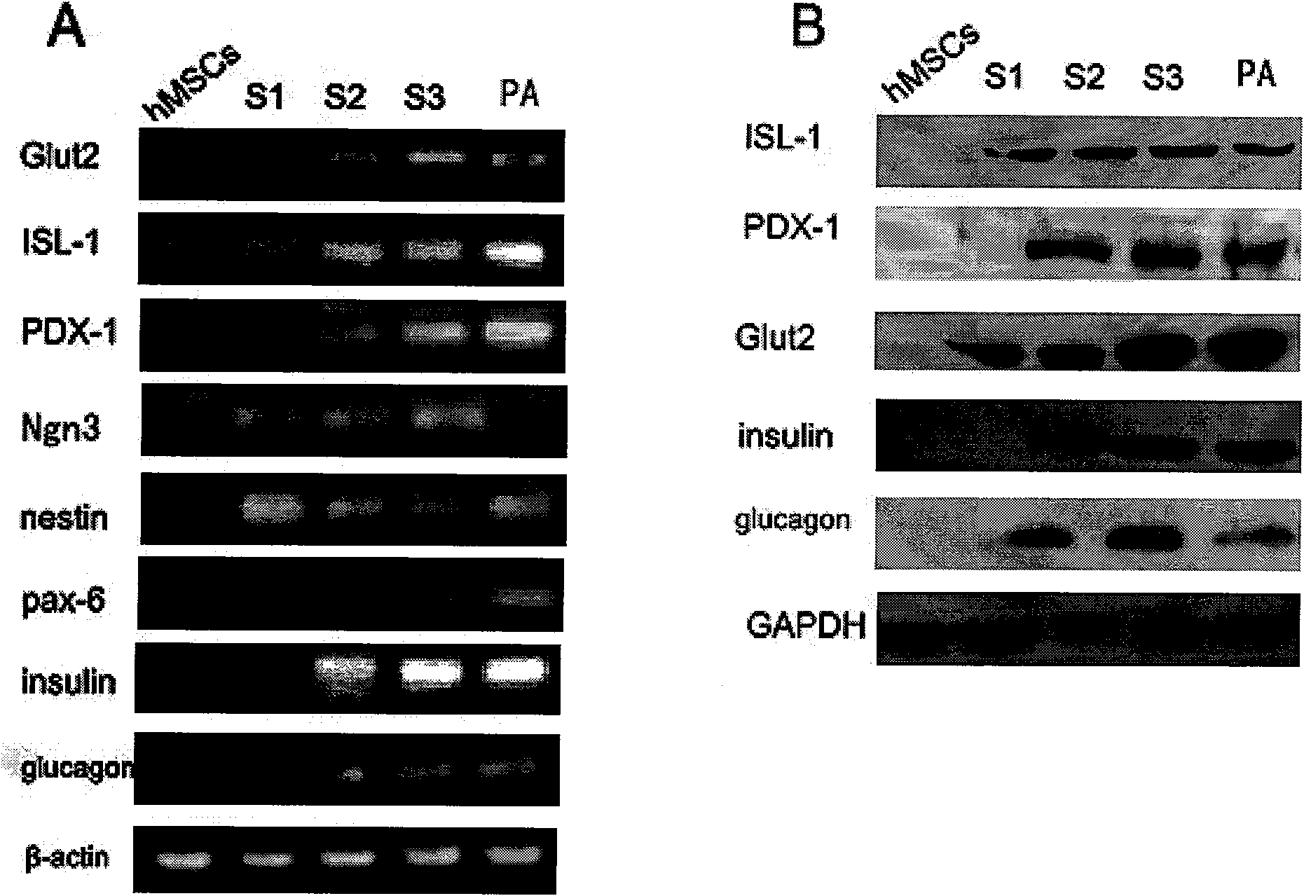 Method and combined medium for preparing insulin-like secreting cells