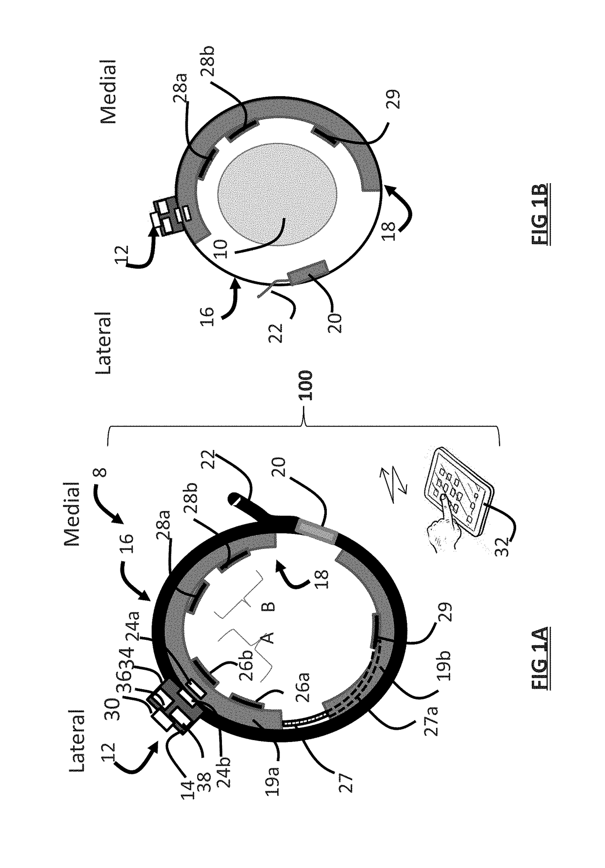 Systems and methods for assessing pelvic floor disorder therapy