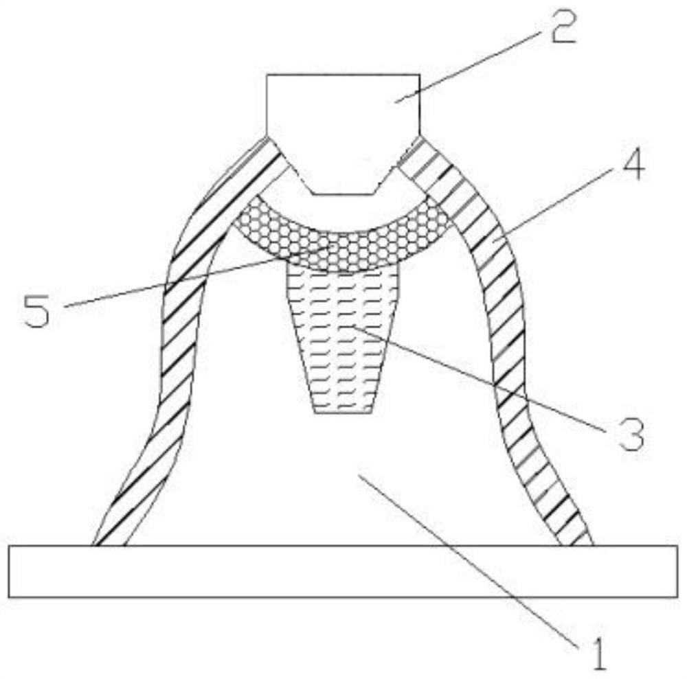 A closure device for avoiding bone resorption around dental implants